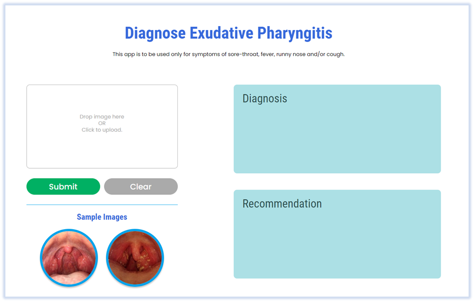 Screenshot of web app for diagnosing exudative pharyngitits - pre patient image upload