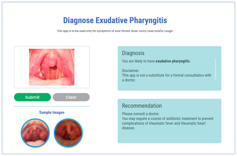 Screenshot of web app for diagnosing exudative pharyngitits - post image upload with diagnosis and recommendation displayed